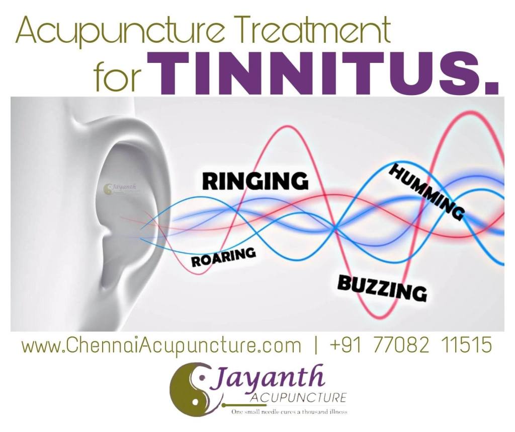 Acupuncture Treatment For Tinnitus in Chennai - Faster Recovery