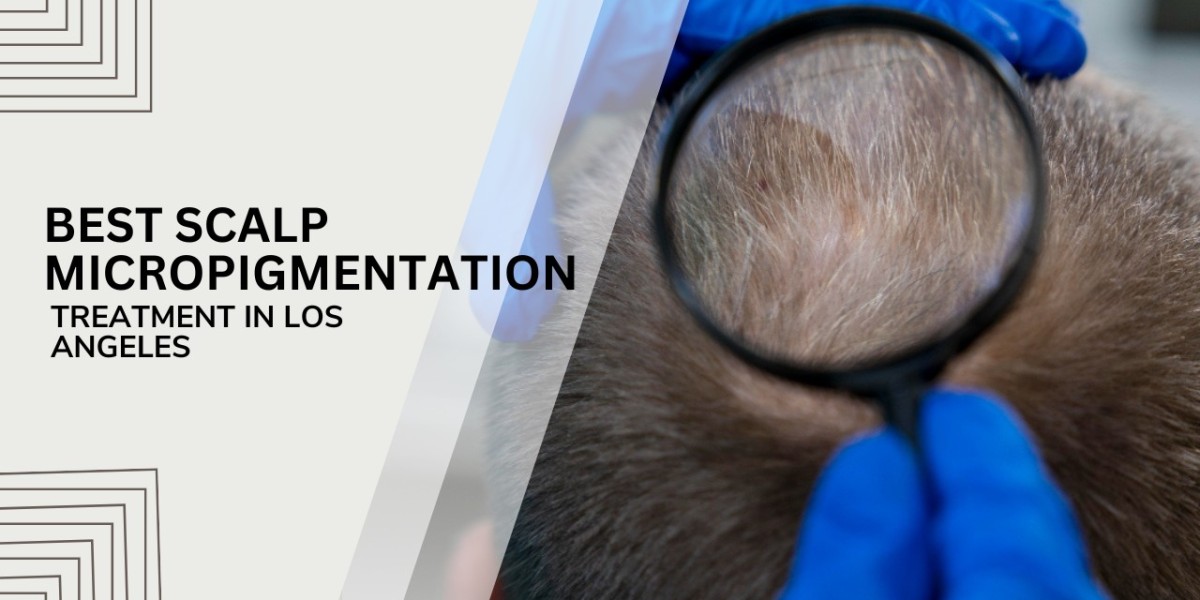 Best Scalp Micropigmentation treatment in Los Angeles