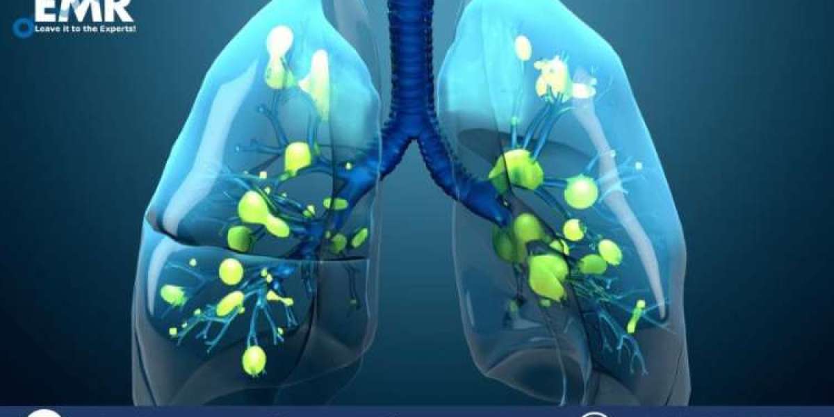 Global Acute Respiratory Syndrome Treatment Market Size, Share, Trends, Growth, Future Outlook | 2024 - 2032