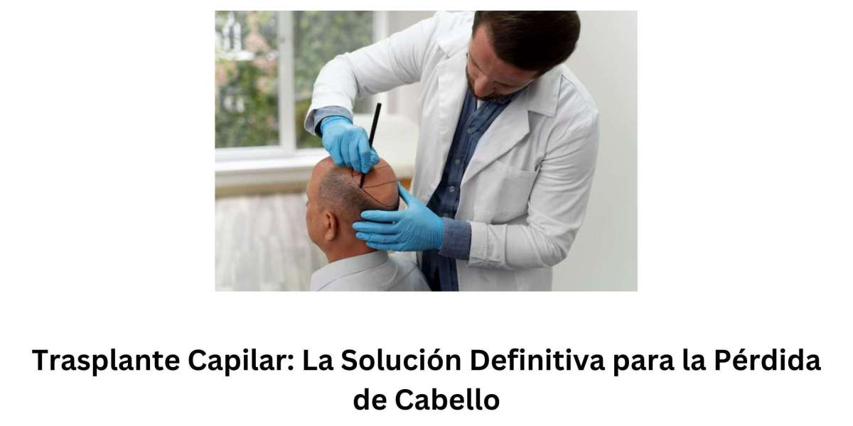 Trasplante Capilar: La Solución Definitiva para la Pérdida de Cabello