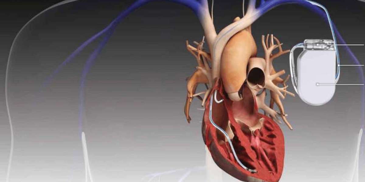 Global Cardiovascular Devices Market | Share | Size | Analysis | Trends | Outlook | Forecast | 2024 - 2032