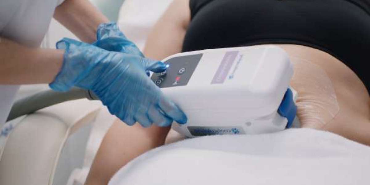 Is Coolsculpting the Right Choice for You in Dubai?