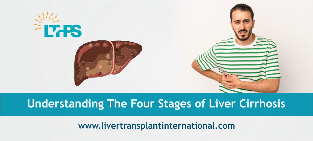 Understanding The Four Stages of Liver Cirrhosis