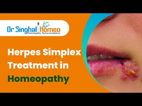 Herpes and Homeopathy: A Safe and Gentle Healing Option – health