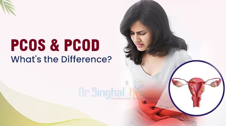 PCOD vs PCOS: What’s the Difference? Symptoms & Treatment