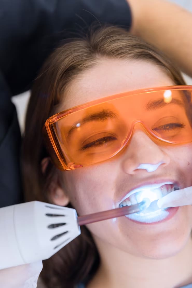 7 Reasons To Consider Professional Teeth Whitening
