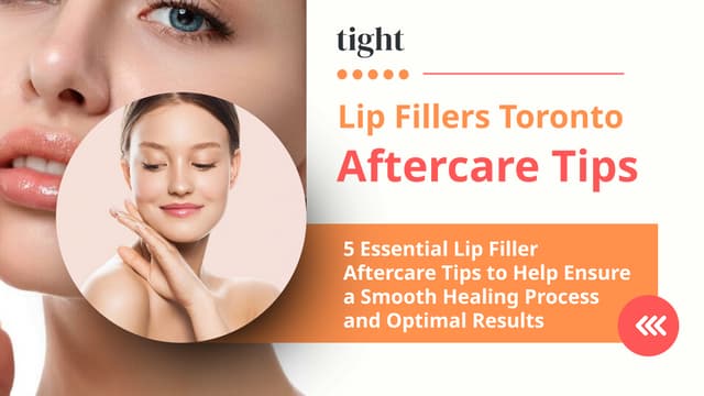 5 Essential Aftercare Tips for Lip Fillers Toronto | PPT