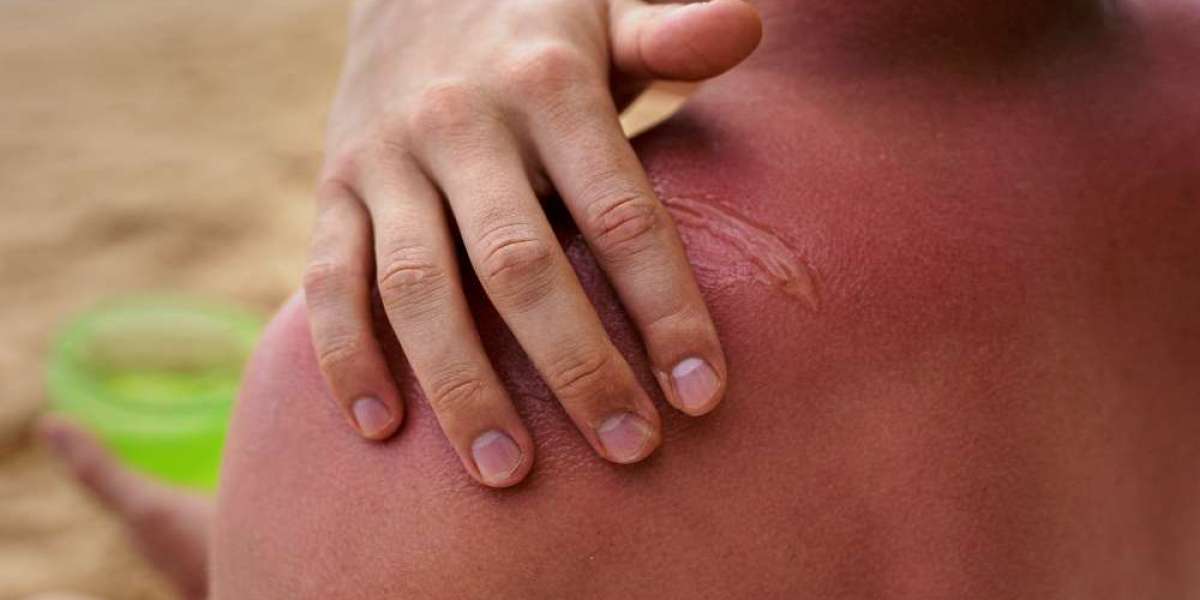 Keloid Therapeutics Market: Future Opportunities and Growth Insights by DelveInsight