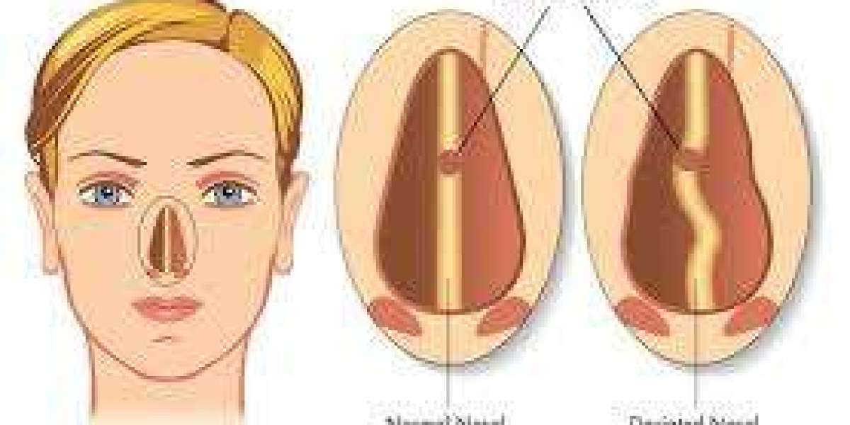 Chronic Sinus Infection Treatment: Top Options for Lasting Sinus Relief