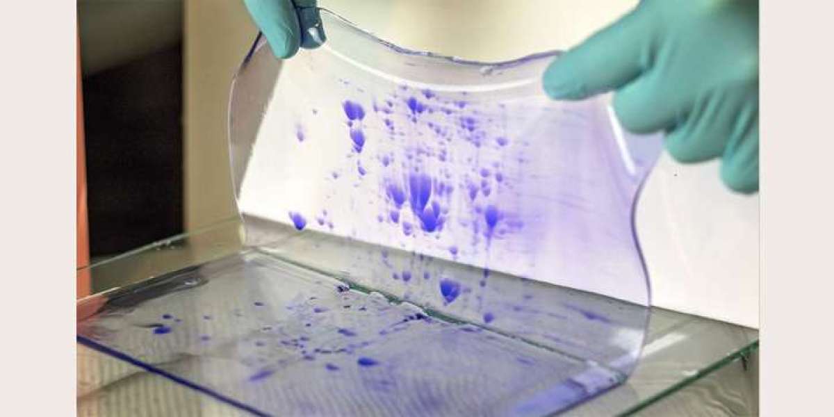 Protein Concentration SDS PAGE for Accurate Profiling