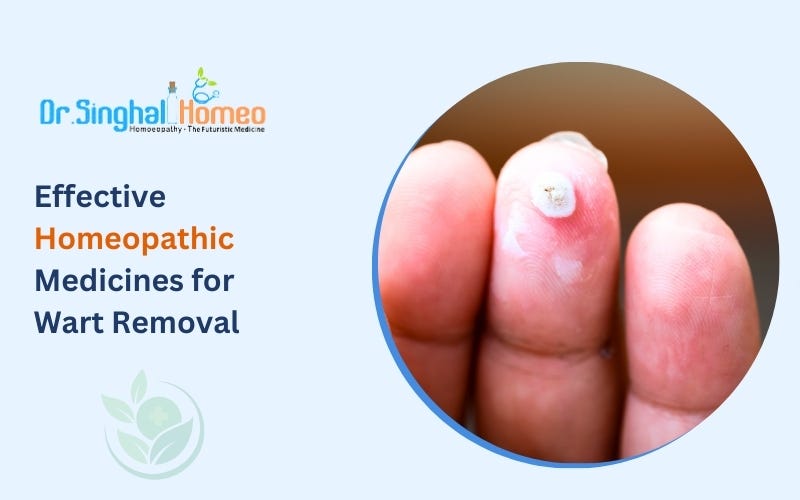 Exploring Homeopathic Medicine for Warts: A Natural Approach | by Dr. Singhal Homeo | May, 2025 | Medium