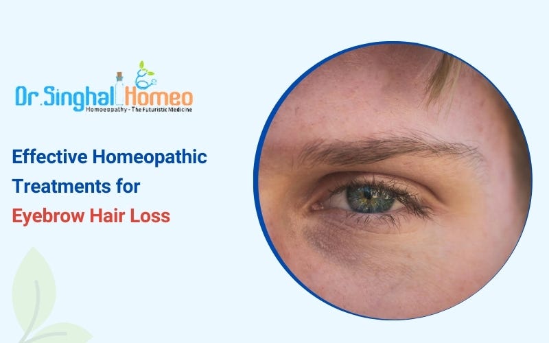 Revive Your Brows: Effective Treatments for Eyebrow Hair Loss | by Dr. Singhal Homeo | May, 2025 | Medium