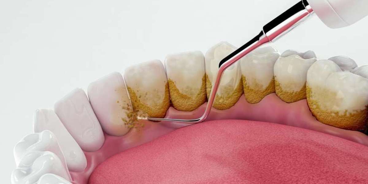 Keep Your Smile Strong Preventive Dentistry in Medford OR