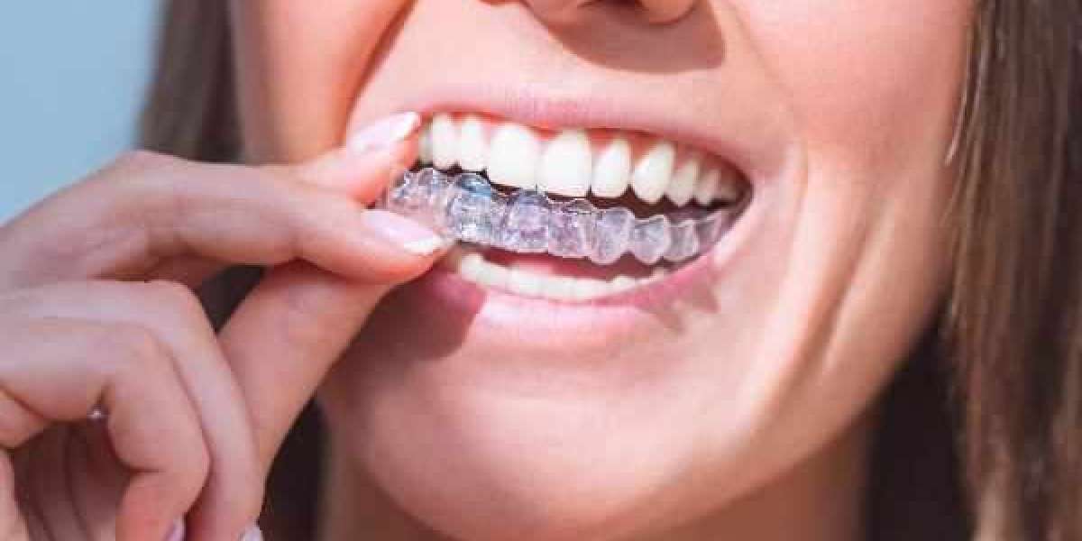 Refined Specialist in Invisible Smile Correction