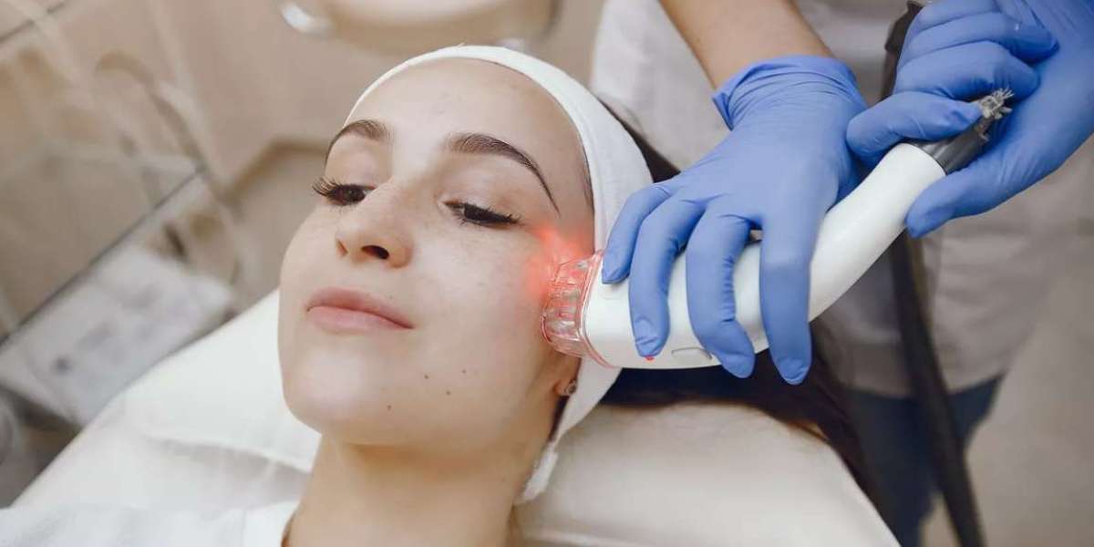 Queen Street South’s Go-To Choice for Laser Scar Removal Mississauga