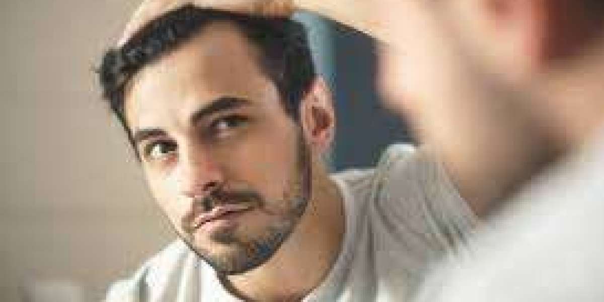 Hair Transplant for Women in Los Angeles: Expert Solutions for Thinning Hair