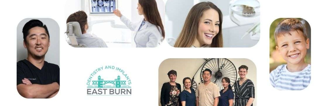 East Burn Dentistry Implants Cover Image