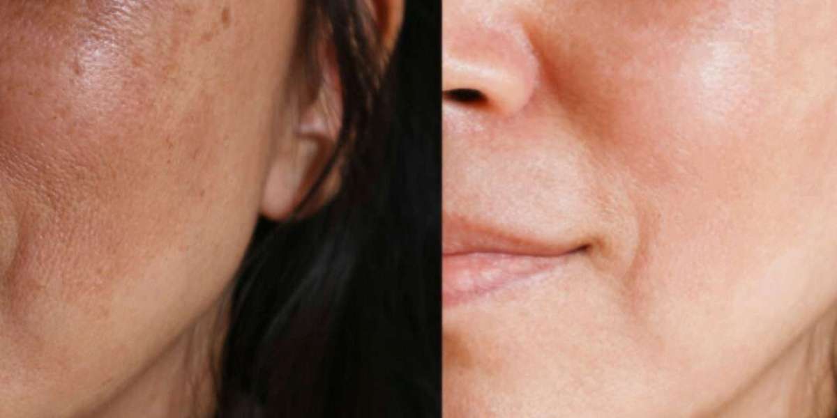Why Dermatologists Don’t Want You to Know About OKDERMO