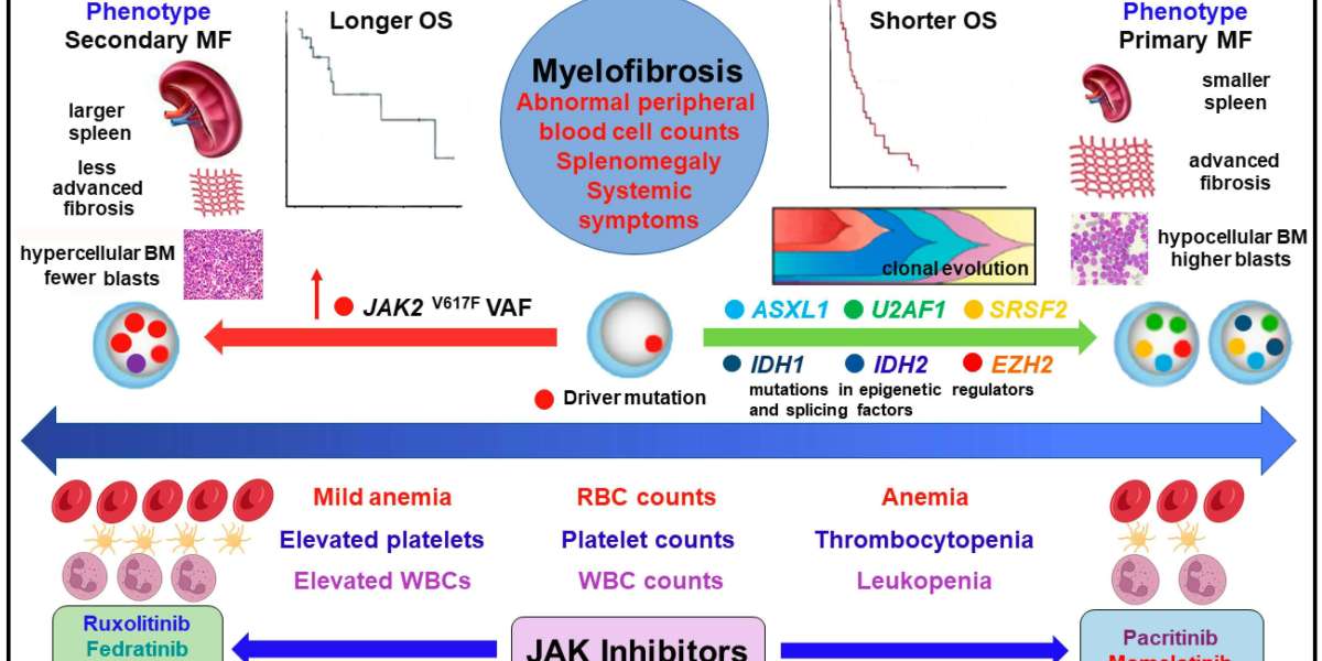 Myelofibrosis: Causes, Symptoms, and Treatment