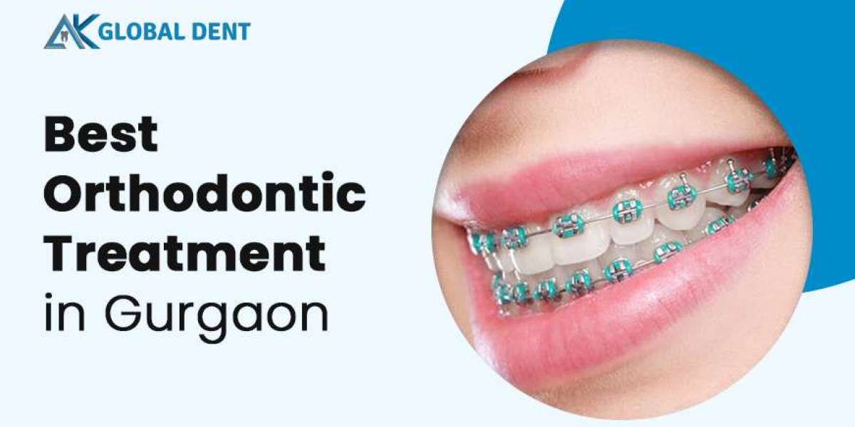 Factors Affecting the Cost of Orthodontic Treatments